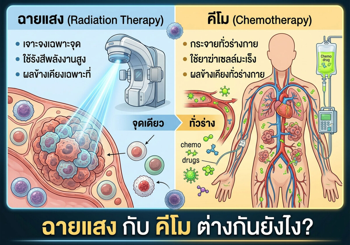 ฉายแสง กับ คีโม ต่างกันยังไง?
